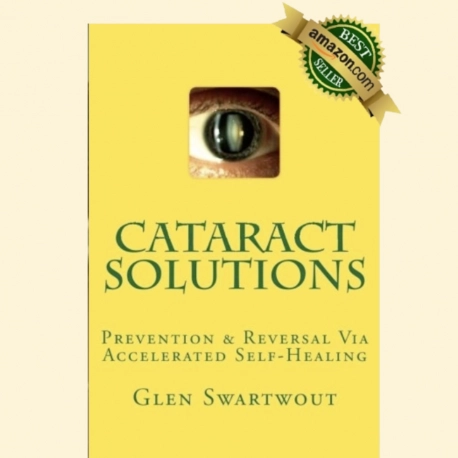 Cataract Solutions ebook