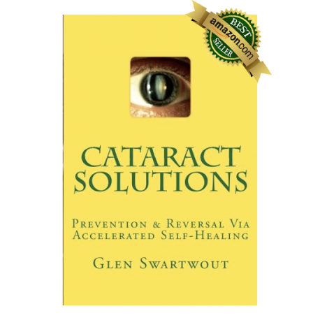 Cataract Solutions Book