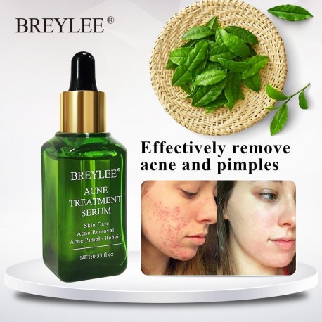 THB Anti ACNE SERUM for Treatment of Cystic Acne & Pimples