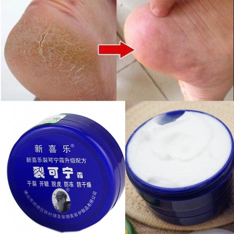 Traditional Chinese 33g Oil Anti-Drying Crack Foot Cream