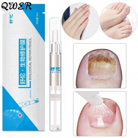 1PC 3ML Anti Fungal Nail Treatment Pen Toe Finger