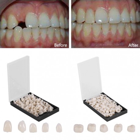 50Pcs/Box Dental Crowns Teeth Whitening
