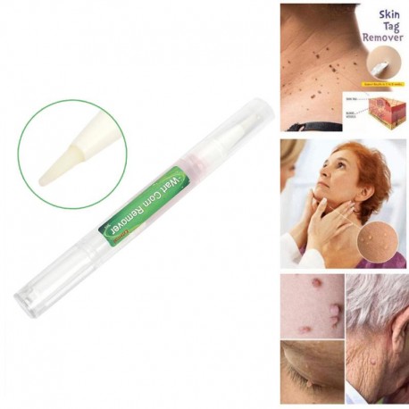 5 Days 3ml Effective Skin Tag Remover Pen Natural Health Mole Nevus Wart Skin Tag Warts Treatment Skin Tag Removal 1Pc|Creams|  