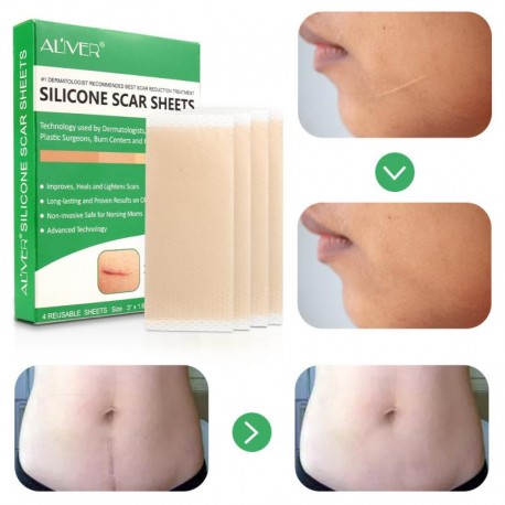 New Scar Away Patch Removal Cesarean Keloid Skin Scars Therapy Treatment Silicone Gel Sheet Wound Marks Removal Scar Patch|Cream