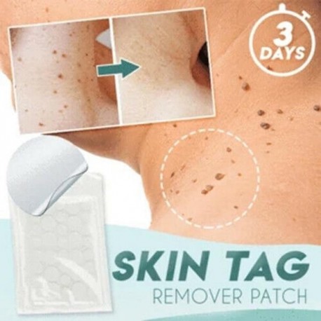 Skin Tag and Acne Master Patch Sticker Face Facial Skin Care Cover Safe Beauty Hydrocolloid Acne Invisible Pimple Master Patch
